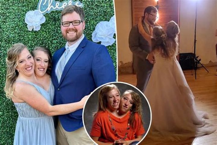 What Really Happened To Abby And Brittany Hensel? Did They Pass Away?
